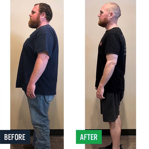 Matt side before and after