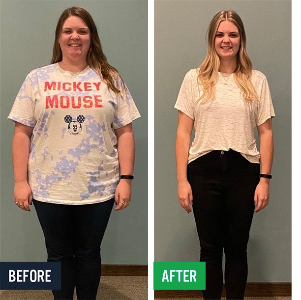 Meghan before and after