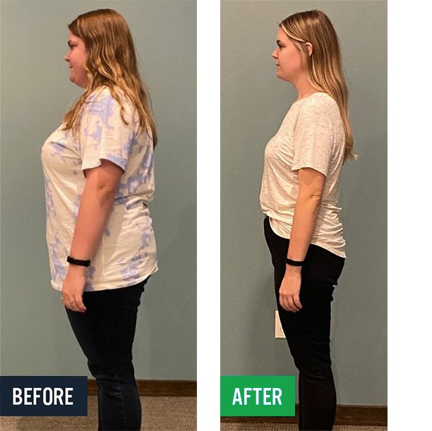 Meghan side before and after