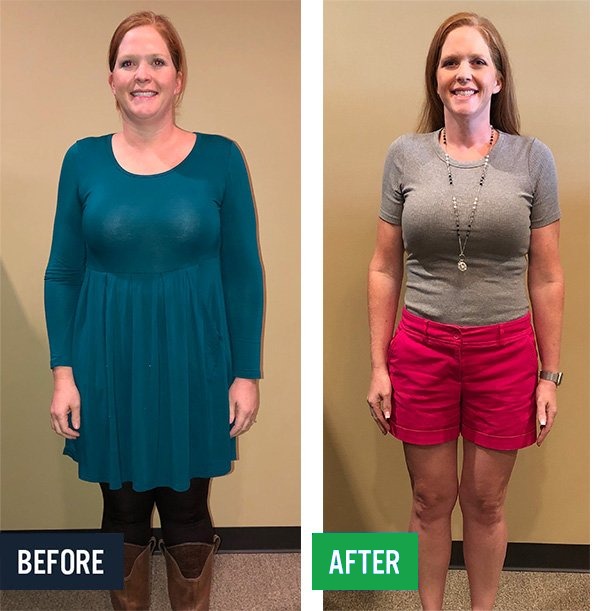 Meredith before and after