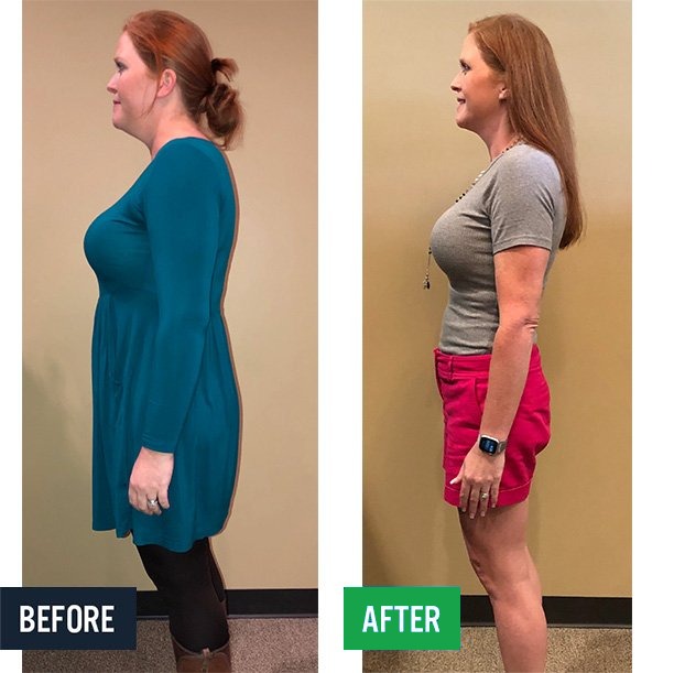 Meredith side before and after