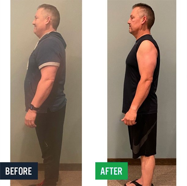 Mike side before and after