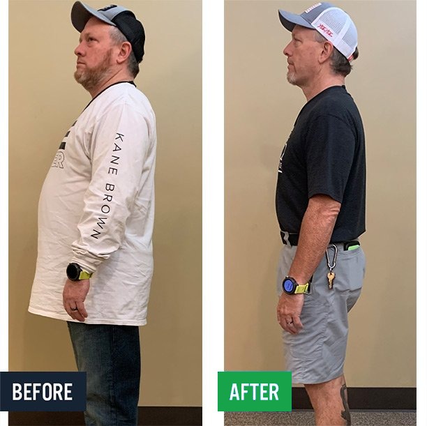 Nick side before and after