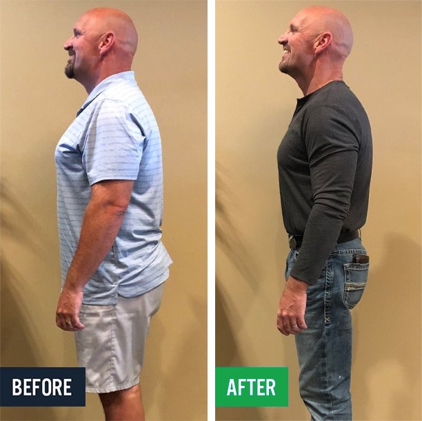 Pat side before and after