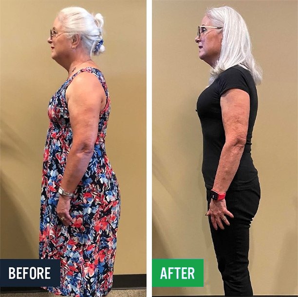 Paula side before and after