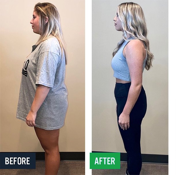 Presley side before and after