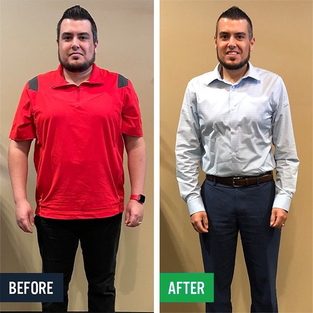 Raul before and after