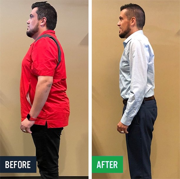 Raul side before and after