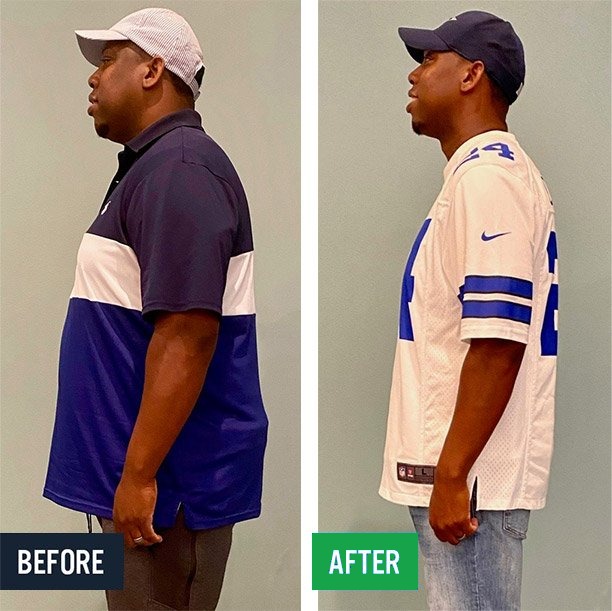 Rico side before and after