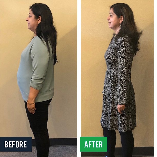 Satvinder side before and after