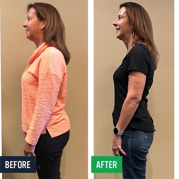 Sherri side before and after