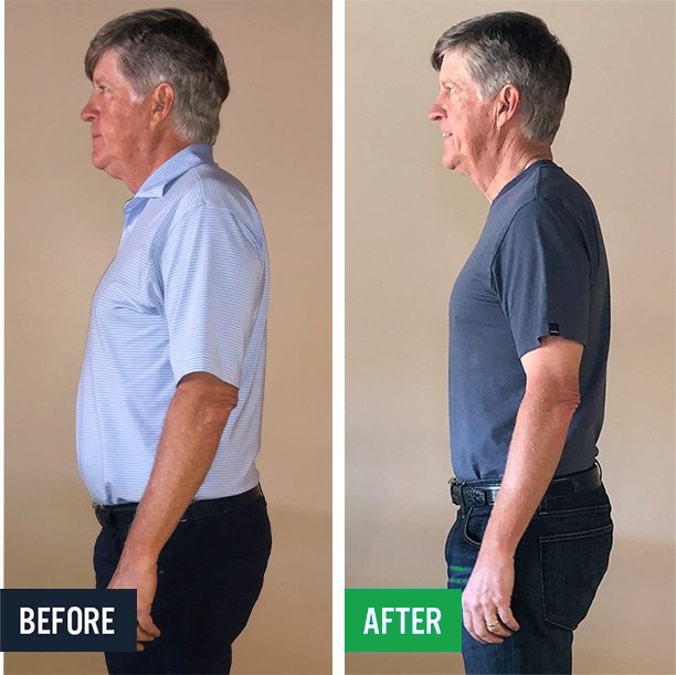 Steve side before and after