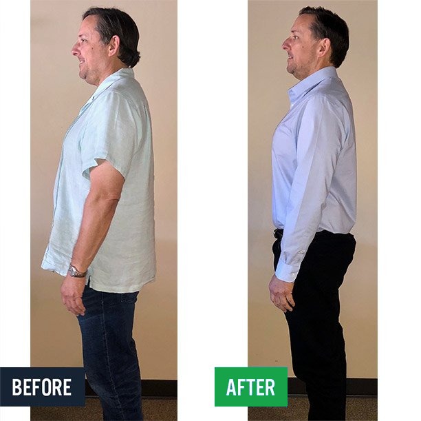 Steve side before and after