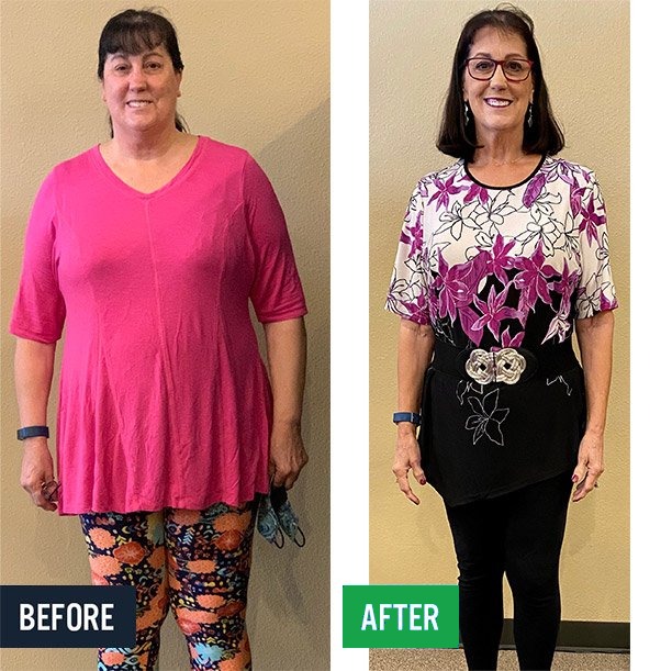 Susan before and after