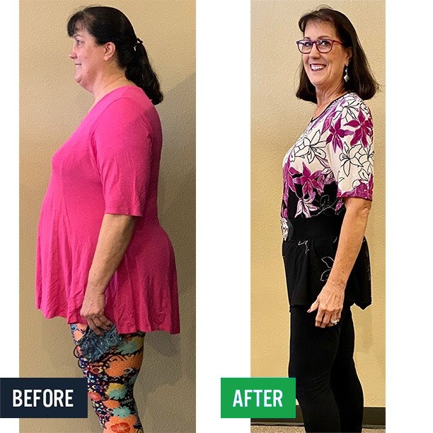 Susan side before and after