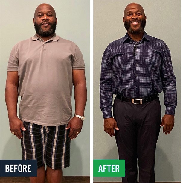 Terry before and after