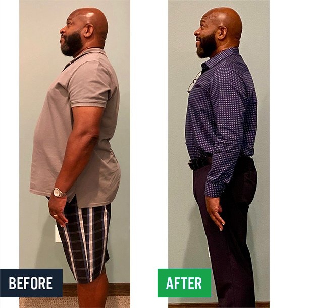 Terry side before and after