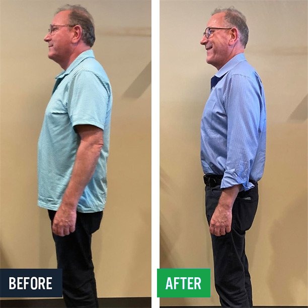 Tom side before and after