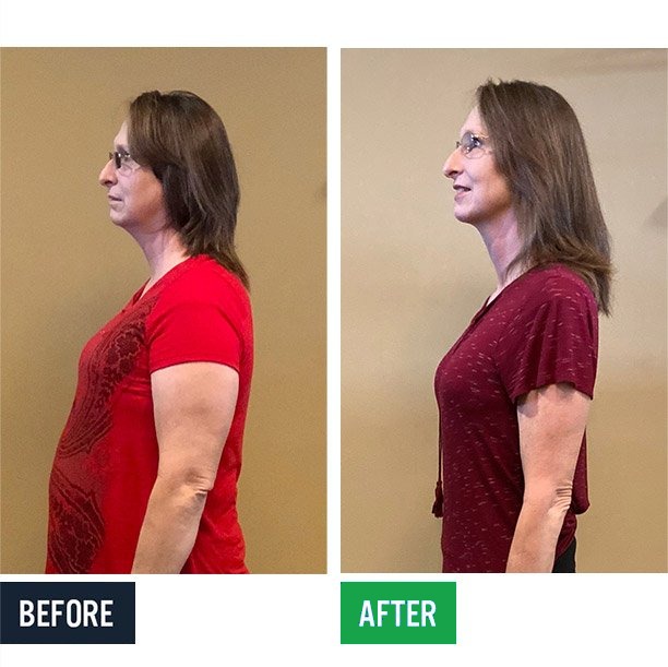 Wendy side before and after